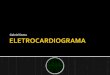 Aula Eletrocardiograma Gabriel Dotta[2009]