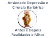 Depressão - Ansiedade- Cirurgia Bariátrica Sobracil2014para pdf