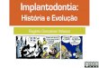 Implantodontia - História e Evolução