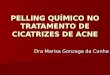 PELLING QUÍMICO NO TRATAMENTO DE CICATRIZES DE ACNE Dra Marisa Gonzaga da Cunha