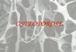 OSTEOPOROSE. O QUE É? Osteoporose, que significa osso poroso, é uma doença resultante da perda gradual da substância óssea que ocorre naturalmente com