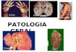 PATOLOGIA GERAL Osteoporose Artrite TEP Cirrose Infarto cerebral