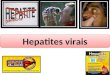Hepatites virais. HEPATITES Doença inflamatória do fígado Inflamação dos hepatócitos ABCDEABCDE ABCDEABCDE Dengue Malária Toxoplasmose Mononucleose Citomegalovírus