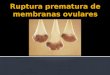 Rotura prematura de membranas ovulares (RPMO) é a rotura espontânea das membranas (âmnio e cório) antes do início do trabalho de parto, independente da