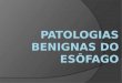 Patologias Benignas do Esôfago Dra. Julia Pedroni de Carvalho Médica Residente (R1) – Cirurgia Geral Hospital Federal Cardoso Fontes Orientador: Dr. Antônio