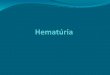 Introdução Eliminação de número anormal de hemácias na urina Macro/Microscópica *UFMG: 680 pacientes - 37% micro - 63% macro Permanente/Recorrente/Isolada