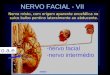 NERVO FACIAL - VII - -nervo facial - -nervo intermédio o.a.e. Netter Nervo misto, com origem aparente encefálica no sulco bulbo pontino lateralmente ao