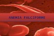 Anemia falciforme apresentação