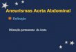 Aneurismas Aorta Abdominal
