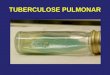 Tuberculose Pulmonar Slide