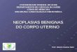 Ginecologia - D. Benigna Do Corpo Uterino - Dr Alberto - IV Turma