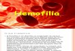 Trabalho Hemofilia Slides