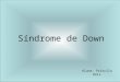 Características Físicas - Síndrome de Down