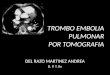 TROMBO EMBOLIA PULMONAR (2)
