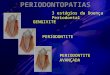Periodontopatia blog