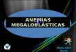 Anemias Megaloblasticas