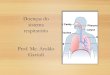 Doenças do sistema respiratório