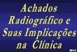 Achados radiográficos e suas implicações na clinica