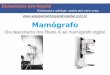 Mamografo - História do mamografo digital