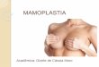 Tipos de Mamoplastia