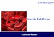 Anemia falciforme  gen©tica