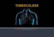 Seminario Tuberculose