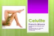 Slide - Celulite - Nutrimaster