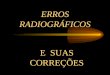 AULA - ERROS RADIOGR+¼FICOS