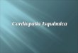 Cardiopatia Isquêmica