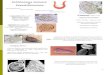 Schistosoma mansoni  e  Esquistossomose