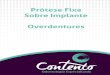 Folheto Digital Contento - Estética - Prótese Fixa Sobre Implante e Overdenture