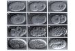 Linhagem celular em Caenorhabditis elegans A origem do tubo digestivo No espaçoNo tempo Maduro & Rothman, Dev. Biol. 246, 68-85, 2002