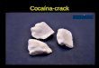 Cocaína-crack. SINAIS E SINTOMAS DA SDA Empobrecimento do repertório Relevância do beber Aumento da tolerância Sintomas repetidos de abstinência Alívio