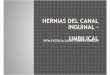 Hernias Del Canal Inguinal – Umbilical