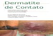 Seminrio Dermatite de Contato 1213848776400478 9
