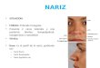 Anatomia de la nariz, senos paranasales y Faringe