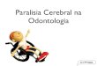 Paralisia cerebral em Odontologia