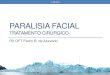 Tratamento Cirúrgico da Paralisia Facial
