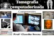Tomografia computadorizada - Claudio Souza · PDF fileVoxel Em tomografia computadorizada e ressonância magnética nuclear as imagens representam as estruturas anatômicas em “cortes”