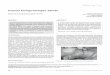 Relato de Caso - SBCCP · O presente trabalho tem como objetivo relatar o caso de uma vítima de trauma cervical penetrante por chifrada de boi, causando lesões de laringe e hipofaringe