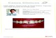 Casos Clínicos - multimedia.3m.commultimedia.3m.com/mws/media/587764O/caso-clinico-de-restauracao-em...Casos Clínicos Foto1: Sorriso inicial mostrando dente 11 fraturado. Casos Clínicos