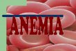 Anemia Falciforme na Gest - HOME - Professora .ANEMIA FERROPRIVA ‰ o tipo de anemia mais comum (