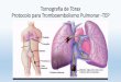 Tomografia de Tórax Protocolo para …claudiosouza.org/portal/wp-content/uploads/2015/10/PROTOCOLO-PA… · Tromboembolismo Pulmonar Definição: O tromboembolismo Pulmonar –TEP