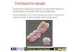 Apresentação do PowerPointcbsflab.com/wp-content/uploads/2017/03/alteracoes-cromossomicas-2… · ~10% das doenças mendelianas são ligadas ... FREQÜÊNCIAS DAS PRINCIPAIS ANOMALIAS