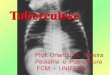 Tuberculose - Orlando A. Tuberculose Primria p Tuberculose p³s ... extrapulmonar (exceto meningite)