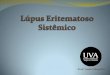 Lúpus Eritematoso Sistêmico (LES) 5... · nariz e as bochechas com tendência a poupar os sulcos ... Hemorragias Pulmonares: ... (PCR): Diminuída