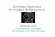 Morfologia Matemática em Imagens de Ressonânciaaconci/MorfologiaReconstrucao.pdf · magnética como uma técnica de diagnóstico e a obtenção de imagens do interior de corpos