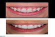 * Doutora, Mestre e Especialista em Dentística pela UFSC ... · associação com a evolução dos sistemas adesivos e materiais cerâmicos, originou uma nova era odontológica, 