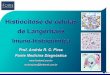 Histiocitose de células de Langerhans Imuno-histoquímica Langerhans.pdf · Na linfadenopatia dermatopática e outras linfadenopatias reacionais Timócitos corticais (linfócitos