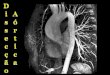 Histórialamurgem/DAA.pdf · Tomografia computadorizada ... Sem contraste ou irradiação Imagens em vários planos Patência coronariana ... Slide 1 Author: